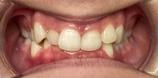 Caso clínico pre tratamiento