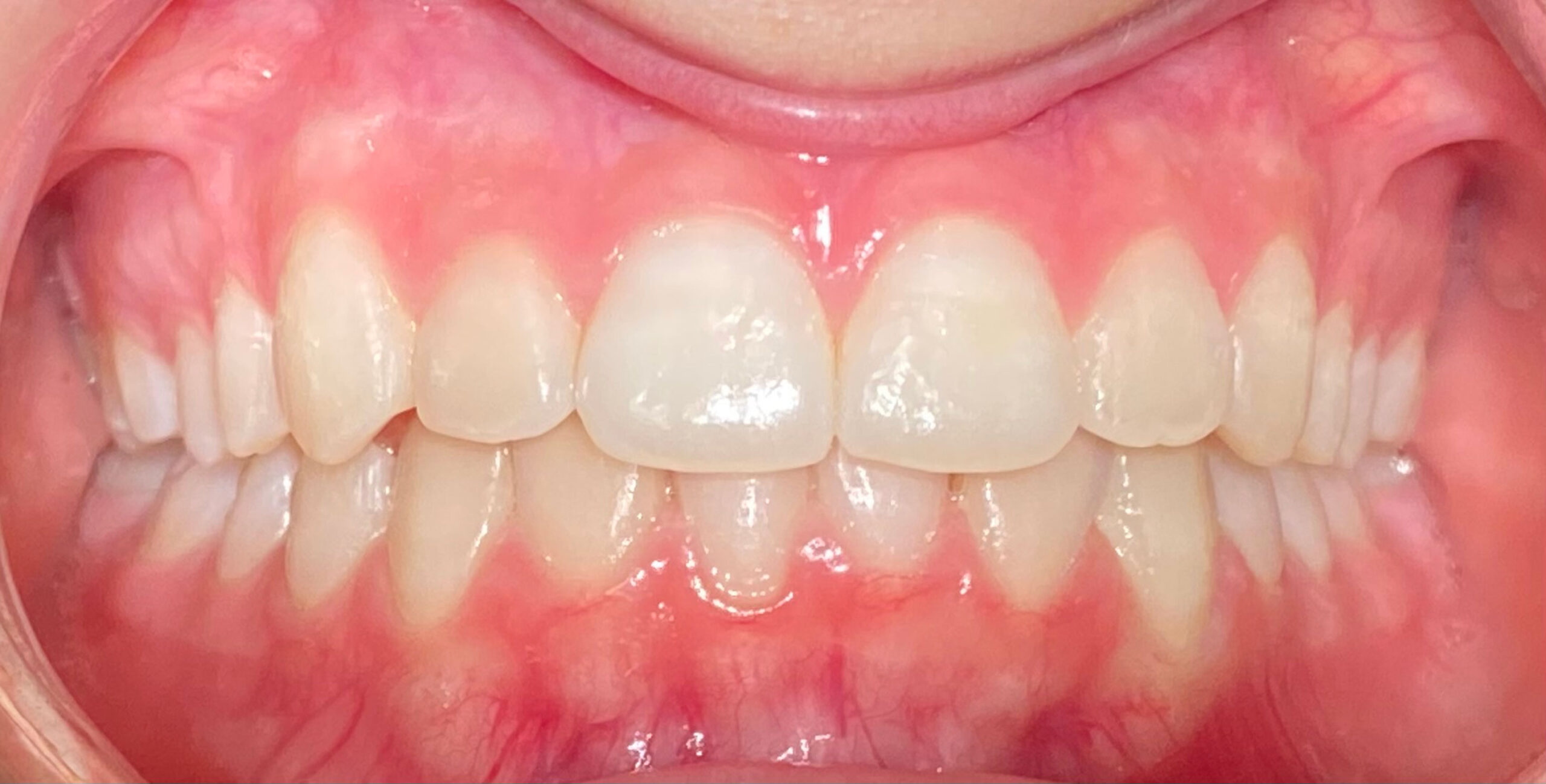 ortodoncia caso clínico